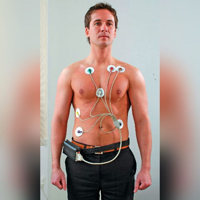 1-Channel Holter Monitor 2
