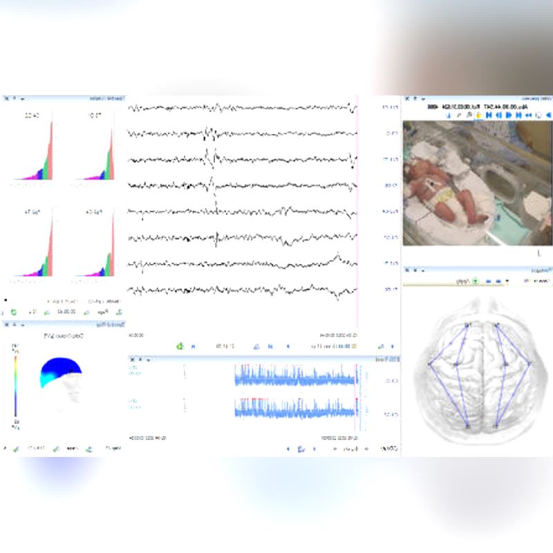 64-Channel Eeg System – Goldstar Medical Equipment