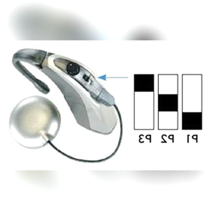 Behind-The-Ear Processor Cochlear Implant 3