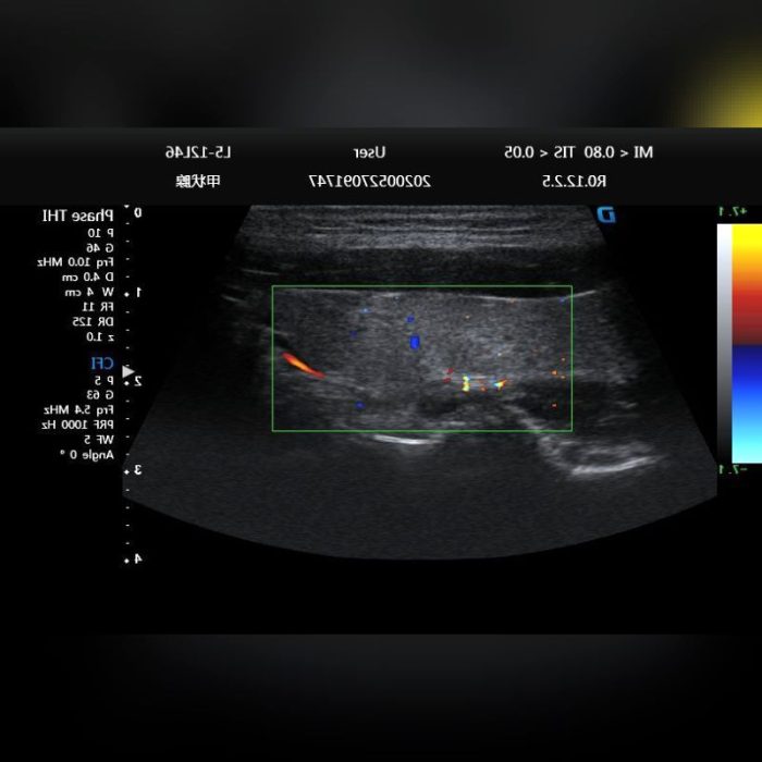 Cardiovascular Ultrasound Imaging System 9