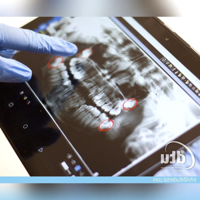 Dental Imaging Medical Tablet Pc 2