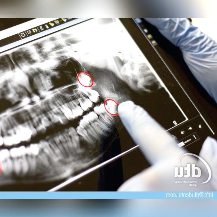 Dental Imaging Medical Tablet Pc 3