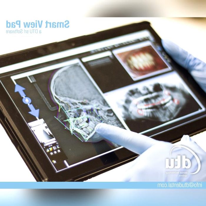Dental Imaging Medical Tablet Pc 4