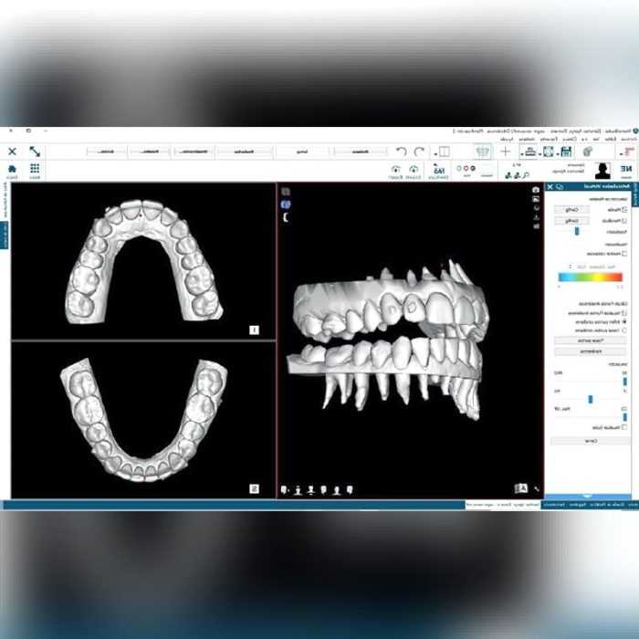 Dental Imaging Software 1