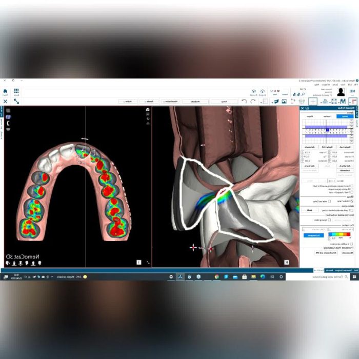 Dental Imaging Software 4