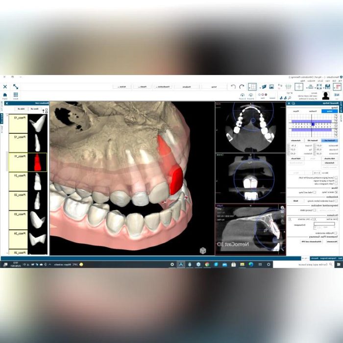 Dental Imaging Software 5