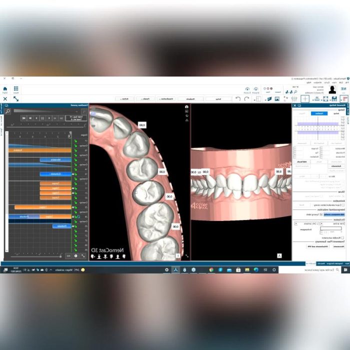 Dental Imaging Software