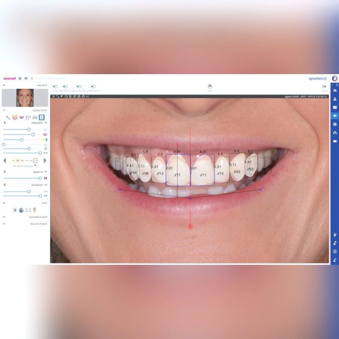 Dental Software 2