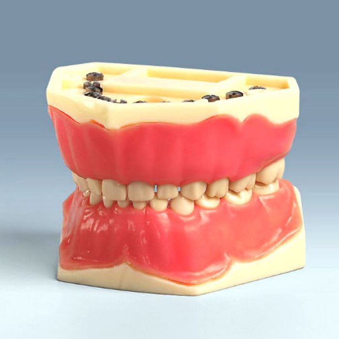 Denture Model
