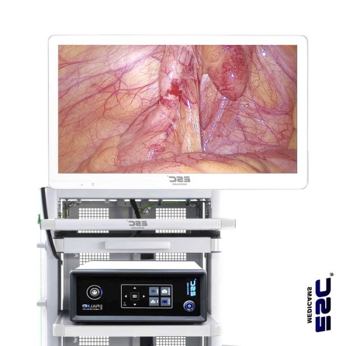 Endoscopy Video Processor 2