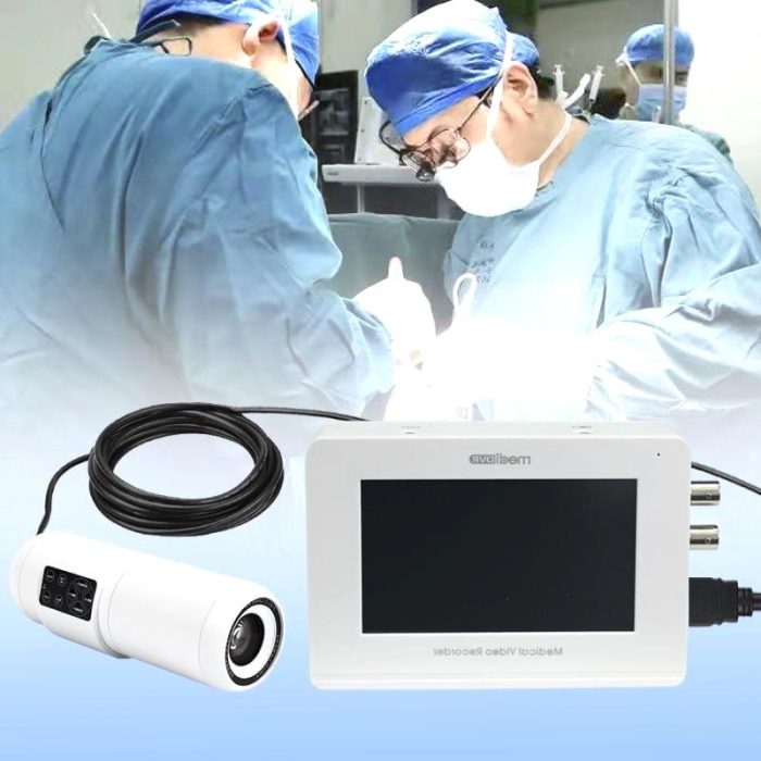 Endoscopy Video Recorder 1