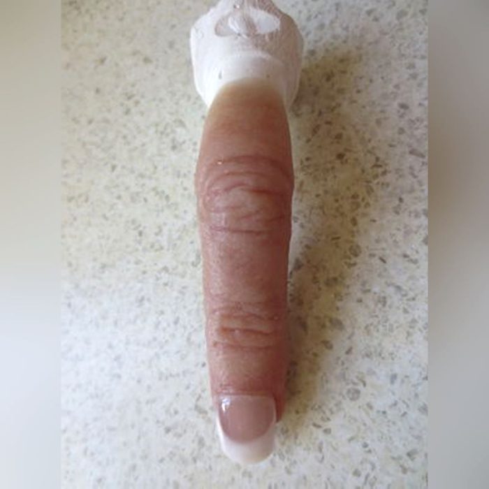 Finger Cosmetic Prosthesis 1