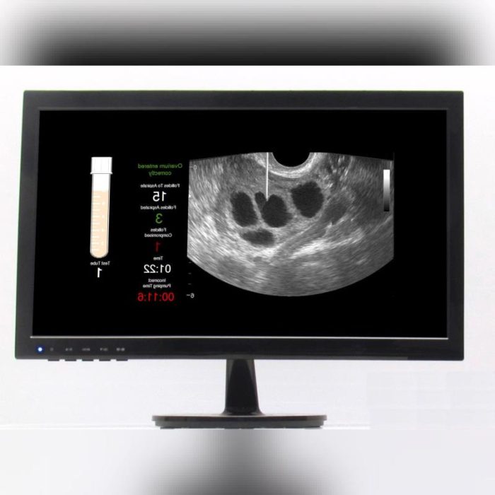 Gynecological Surgery Simulator 1