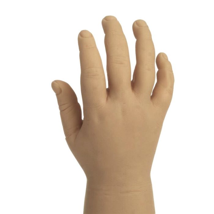 Hand Cosmetic Prosthesis
