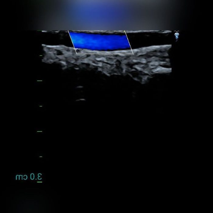 Hand-Held Ultrasound System 4