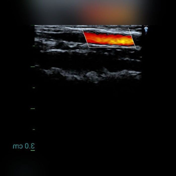 Hand-Held Ultrasound System 5