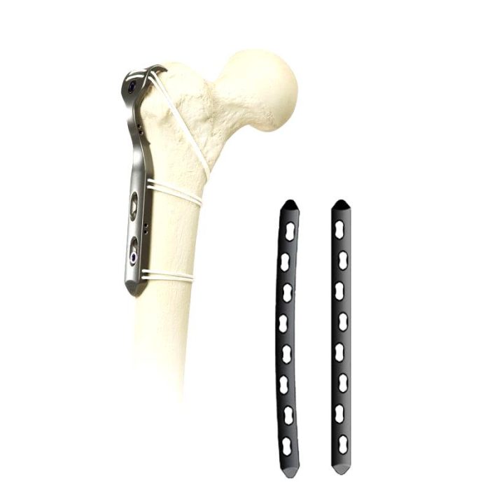Hip Revision Surgery Bone Cerclage Wiring