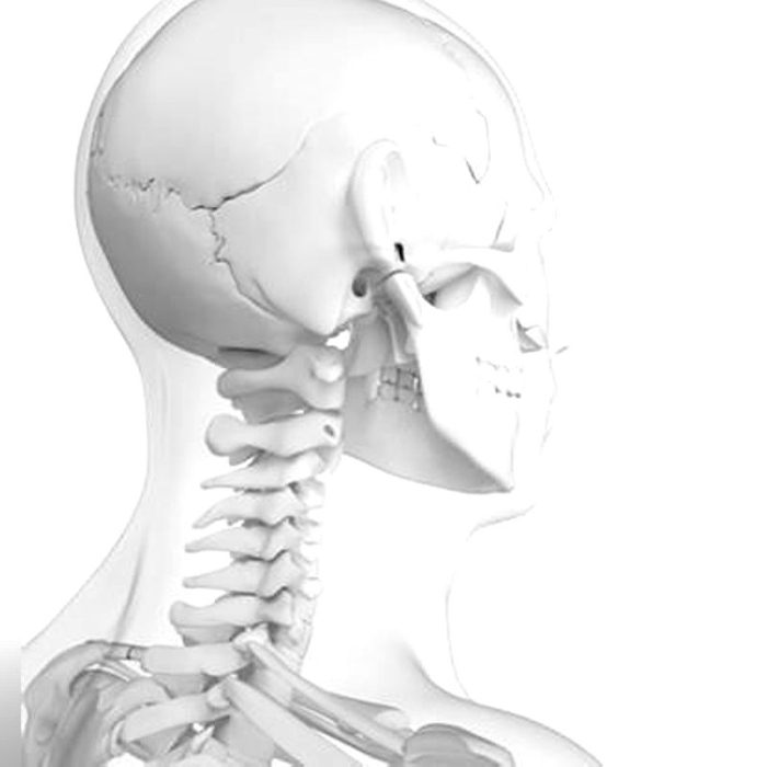 Internal Component Bone Conduction Implant 2