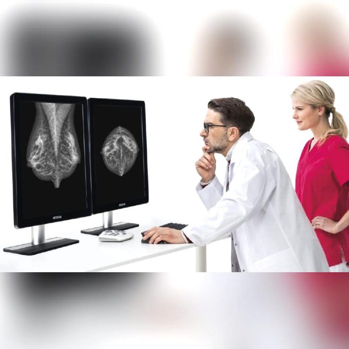 Mammography Computer Workstation