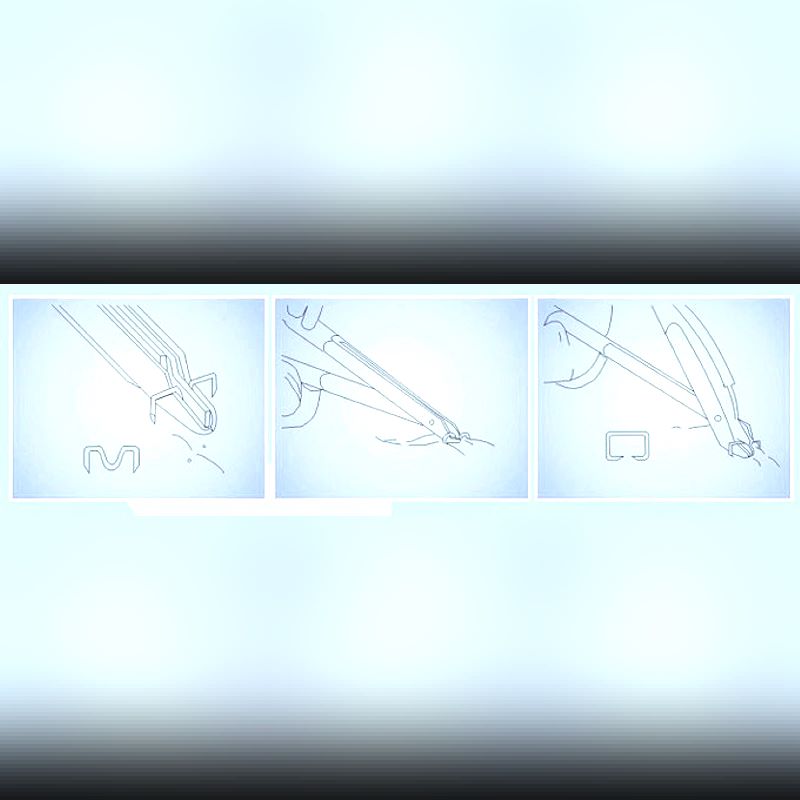 Durable Medical Staple Remover Sale or Rent Near Me Goldstar Medical Equipment Store Supply