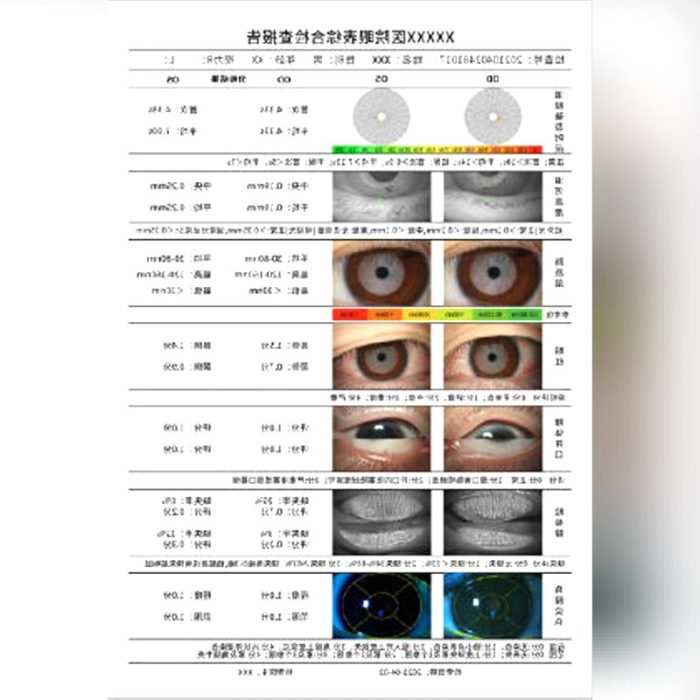 Meibography Dry Eye Diagnosis System 5