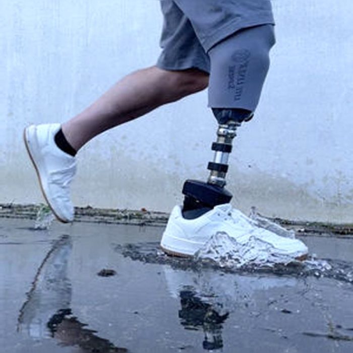 Microprocessor-Controlled Prosthetic Foot 5