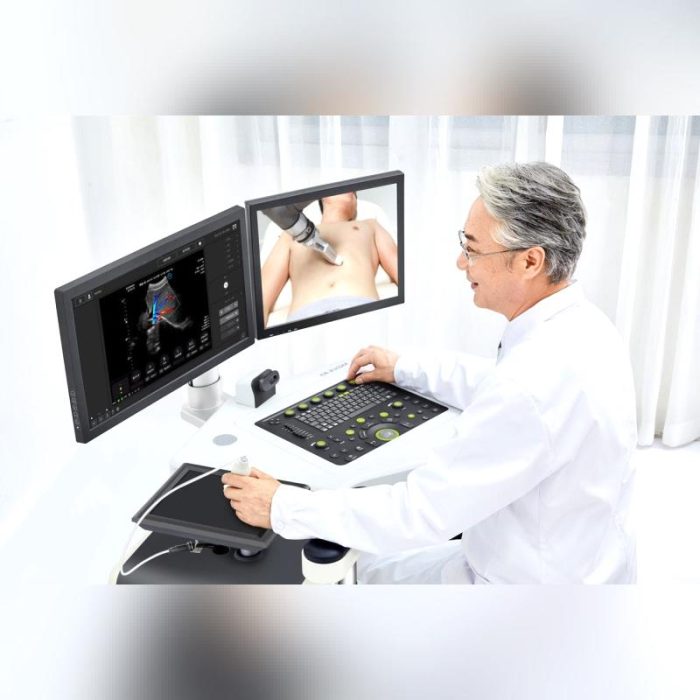 Multi-Purpose Ultrasound Imaging Remote-Controlled Ultrasound System 2