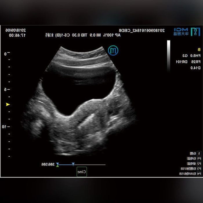 Multi-Purpose Ultrasound Imaging Remote-Controlled Ultrasound System 5
