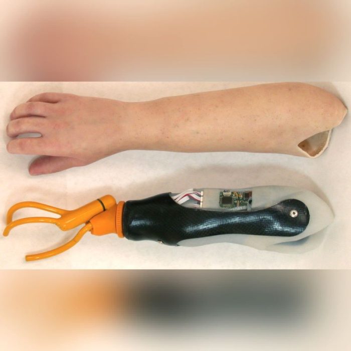 Myo-Electric Hand Prosthesis 5