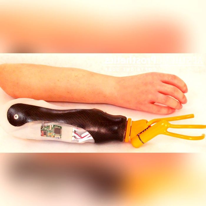 Myo-Electric Hand Prosthesis