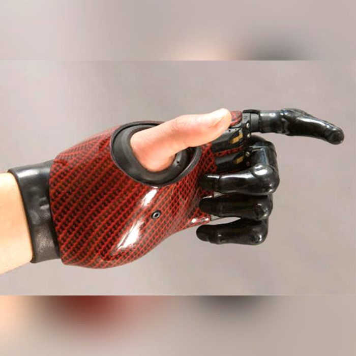 Myo-Electric Partial Hand Prosthesis