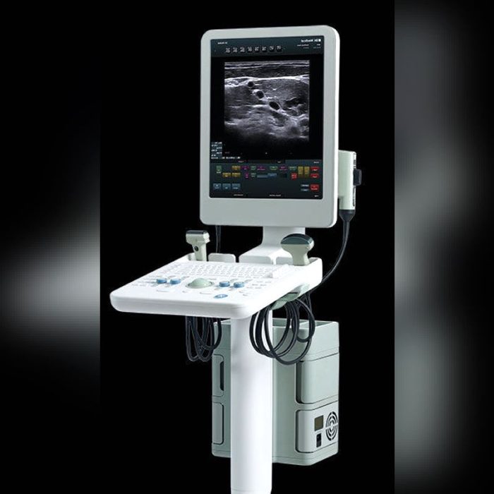 Compact Ultrasound System