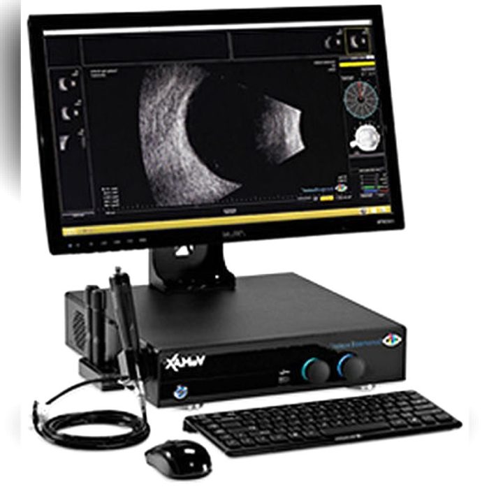 Tabletop Ultrasound System