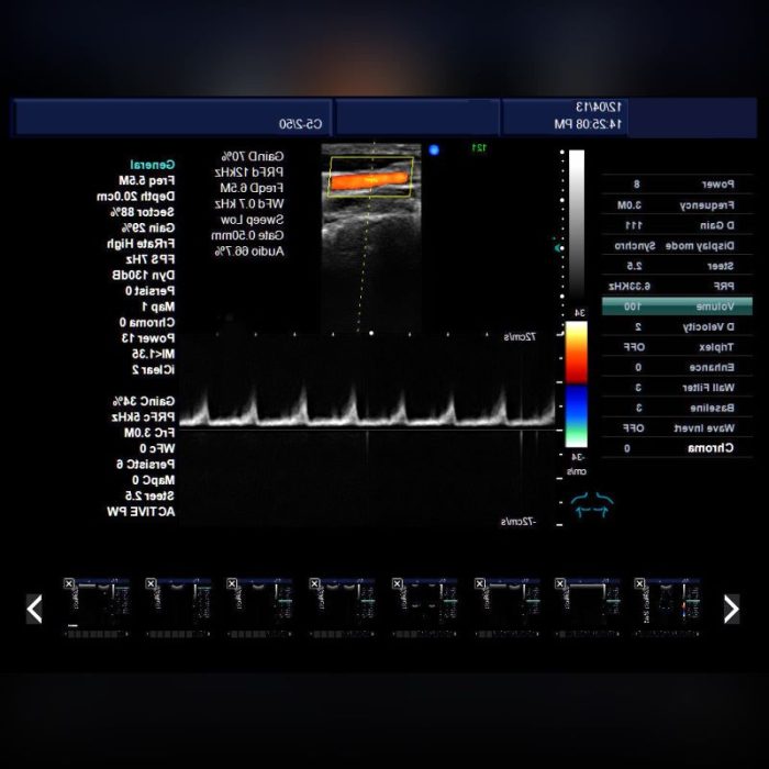 On-Platform Ultrasound System 3