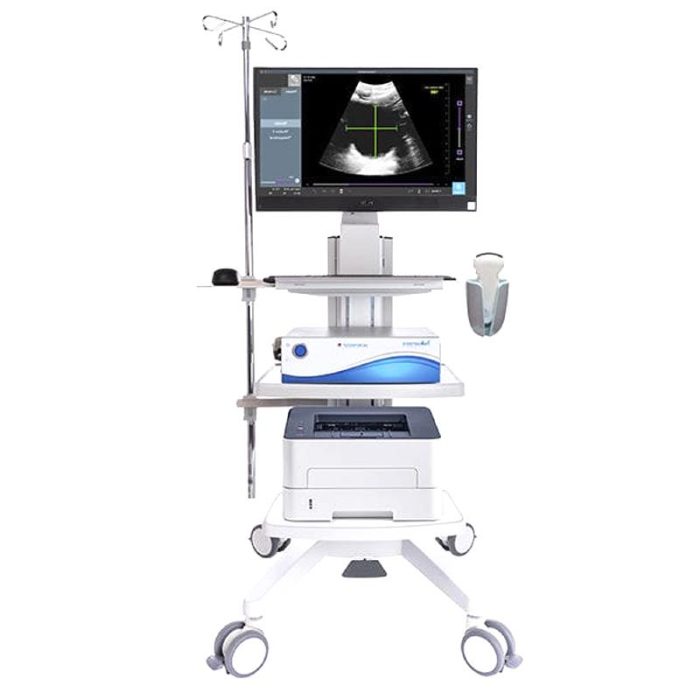 On-Platform Ultrasound System