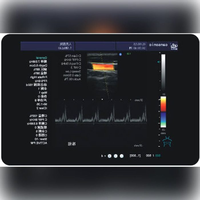 On-Platform Ultrasound System 1