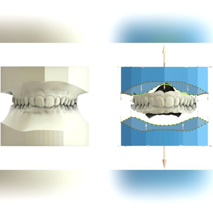 Orthodontic Software 2