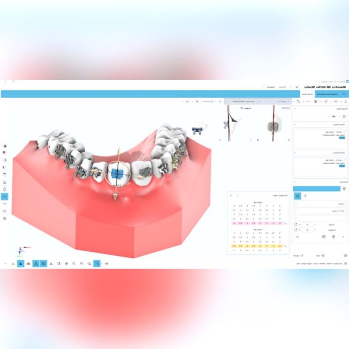 Orthodontic Software 4