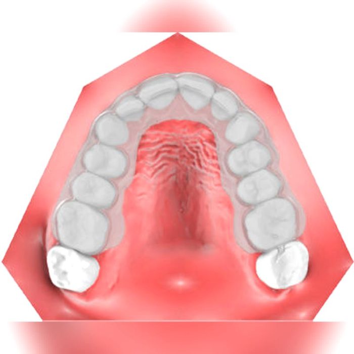 Orthodontic Software 5