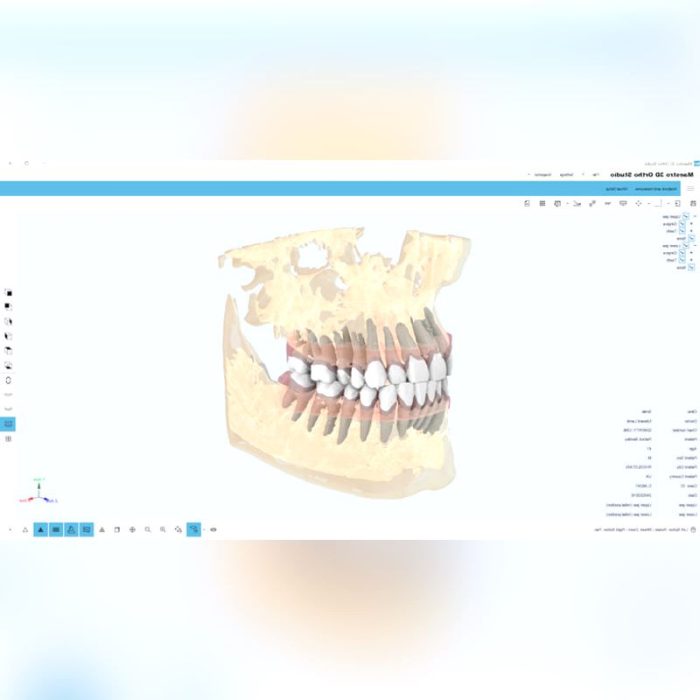 Orthodontic Software 6