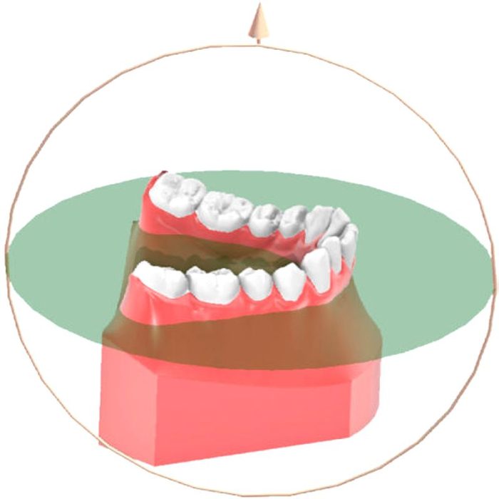 Orthodontic Software