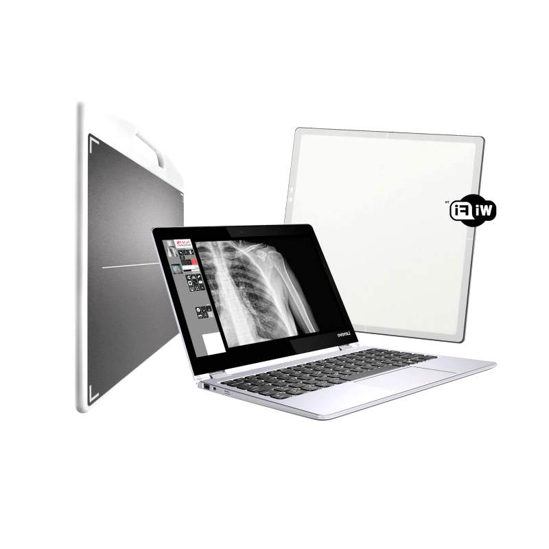 Rarefaction Radiograph Durable Radiography Acquisition System Sale or Rent Near Me – Goldstar ...