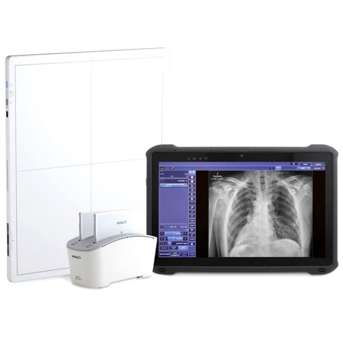Radiography Acquisition System 1