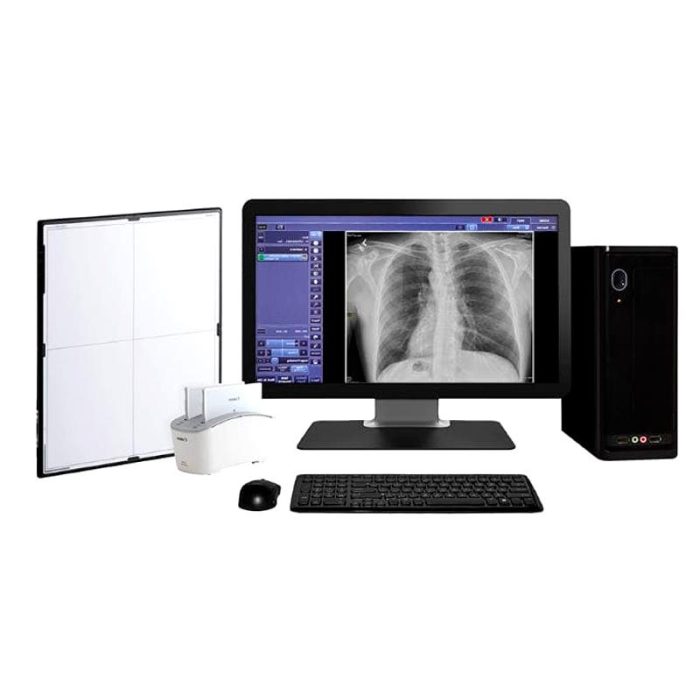 Radiography Acquisition System