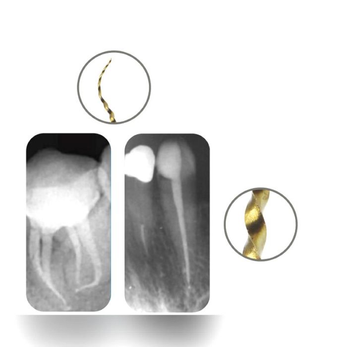 Reciprocating Endodontic File 3