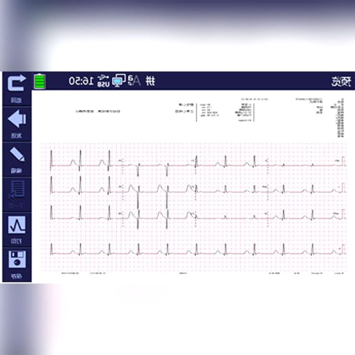 Resting Electrocardiograph 7