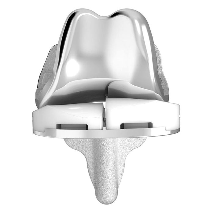 Three-Compartment Knee Prosthesis 1