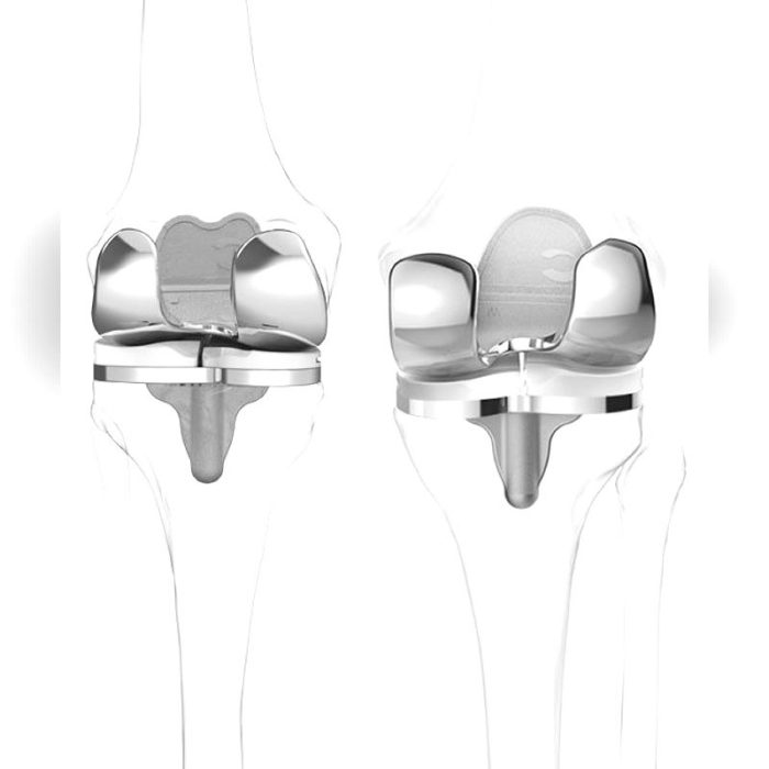 Three-Compartment Knee Prosthesis