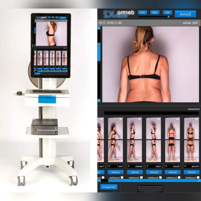 Whole-Body Photography Skin Analysis System 1